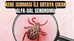 Kene Isırmasıyla Ortaya Çıkan Alfa-Gal Sendromu: Et Alerjisi Belirtileri ve Tedavi Yöntemleri