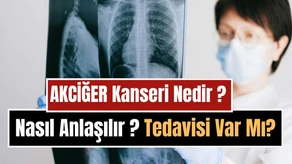 Akciğer Kanseri Nedir, Neden Olur, Nasıl Anlaşılır? Belirtileri, Tedavi Yöntemleri ve Korunma Yolları
