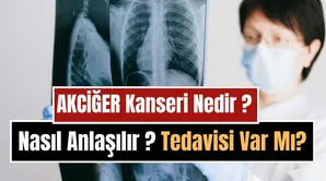 Akciğer Kanseri Nedir, Neden Olur, Nasıl Anlaşılır? Belirtileri, Tedavi Yöntemleri ve Korunma Yolları