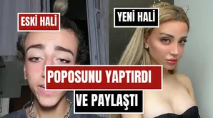 Mika Raun Son Halini Paylaştı! Cinsiyet Geçişini Tamamlayan Fenomen Bu Kez Popo Estetiğiyle Gündemde