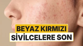 15 günde beyaz ve kırmızı sivilcelere çözüm: Doğal bakım formülü