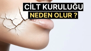 Cilt Kuruluğu Neden Olur? Su İçmek Yeterli mi? Uzmanlar Uyarıyor