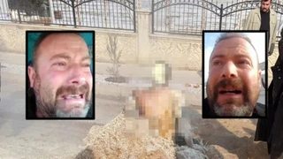 Afşin’de Kendini Ateşe Veren Vatandaşın Durumu Ağır: Belediye Açıklama Yaptı