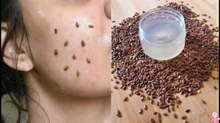 Kleopatra’nın güzellik sırrı keten tohumu olabilir mi? Vitamin deposu jeliyle egzamalara doğal çözüm!