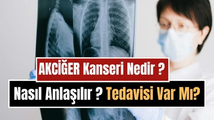 Akciğer Kanseri Nedir, Neden Olur, Nasıl Anlaşılır? Belirtileri, Tedavi Yöntemleri ve Korunma Yolları