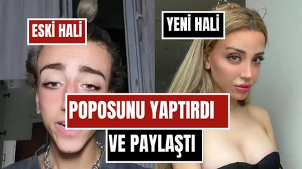 Mika Raun Son Halini Paylaştı! Cinsiyet Geçişini Tamamlayan Fenomen Bu Kez Popo Estetiğiyle Gündemde