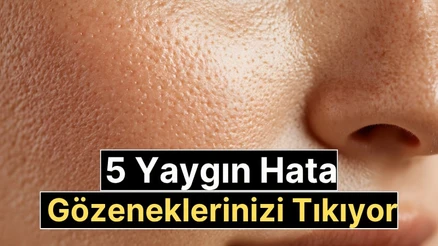 Gözeneklerin tıkanmasına neden olan 5 yaygın hata: Bu alışkanlıklardan uzak durun!