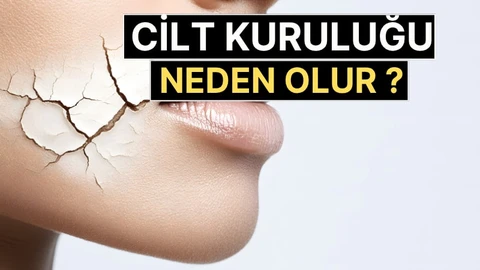 Cilt Kuruluğu Neden Olur? Su İçmek Yeterli mi? Uzmanlar Uyarıyor
