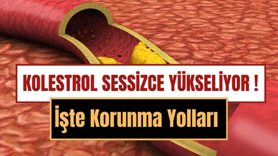 Kolesterol Yüksekliği Nedir, Neden Olur ve Nasıl Düşürülür? Kolesterolü Artıran 15 Besin ve Korunma Yolları