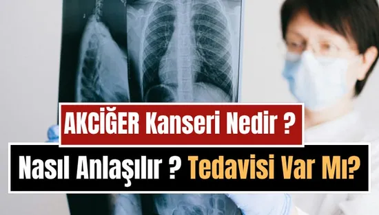 Akciğer Kanseri Nedir, Neden Olur, Nasıl Anlaşılır? Belirtileri, Tedavi Yöntemleri ve Korunma Yolları