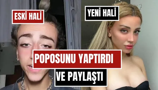 Mika Raun Son Halini Paylaştı! Cinsiyet Geçişini Tamamlayan Fenomen Bu Kez Popo Estetiğiyle Gündemde