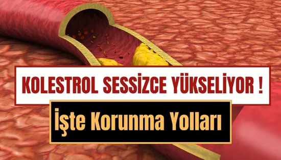 Kolesterol Yüksekliği Nedir, Neden Olur ve Nasıl Düşürülür? Kolesterolü Artıran 15 Besin ve Korunma Yolları