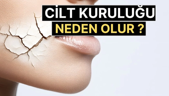 Cilt Kuruluğu Neden Olur? Su İçmek Yeterli mi? Uzmanlar Uyarıyor