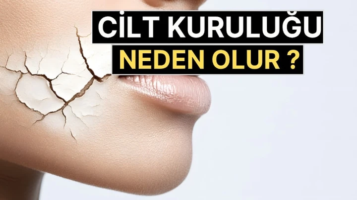 Cilt Kuruluğu Neden Olur? Su İçmek Yeterli mi? Uzmanlar Uyarıyor