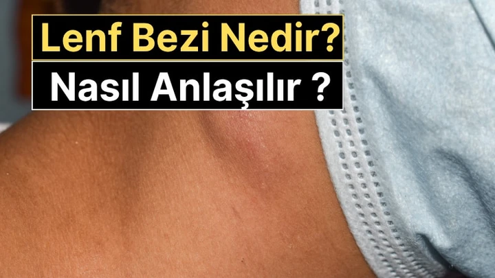 Lenf Bezi Nedir, Neden Şişer? Kanser Belirtisi mi? Nasıl Anlaşılır ?