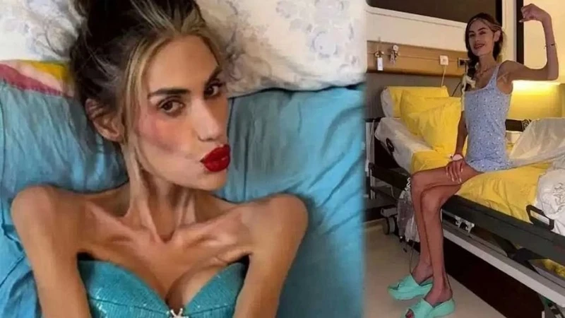 Açlıkla ilgili değil, tehlikeli bir zihinsel bozukluk! Anoreksiya nervoza nedir? Tedavi süreci nasıl ilerler?