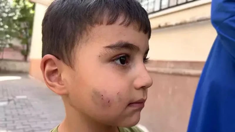 Ankara'da Dehşet: Evde Uyuyan Çocuğu Lağım Faresi Isırdı