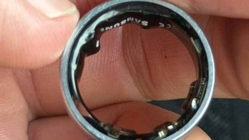 Galaxy Ring Bataryası Şişti – YouTuber Hastanelik Oldu, Samsung'dan Açıklama