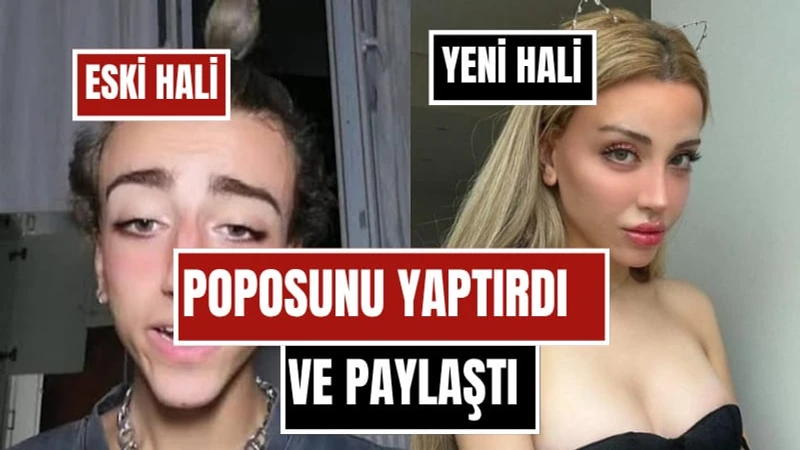 Mika Raun Son Halini Paylaştı! Cinsiyet Geçişini Tamamlayan Fenomen Bu Kez Popo Estetiğiyle Gündemde