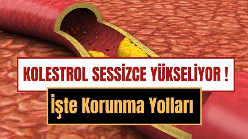 Kolesterol Yüksekliği Nedir, Neden Olur ve Nasıl Düşürülür? Kolesterolü Artıran 15 Besin ve Korunma Yolları
