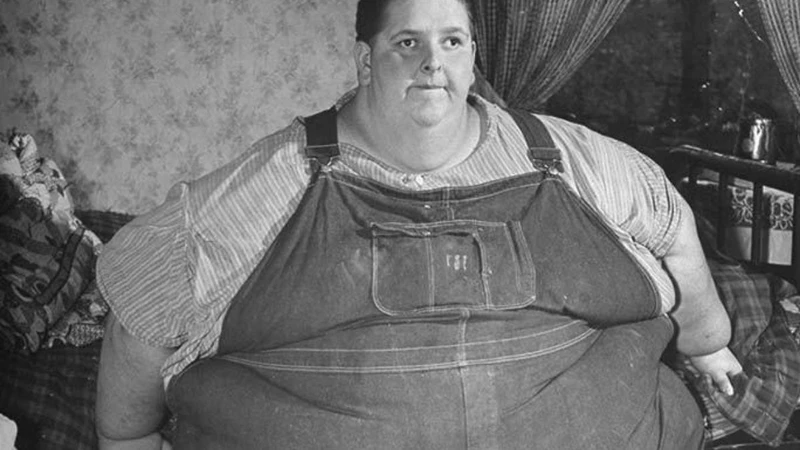 En Şişman İnsan Nasıl 400 Kilo Verdi? Gerçek Hikâye