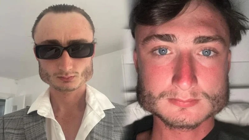 Yıllardır Yaptığı Spor Nedeniyle Yüzü Kareye Döndü