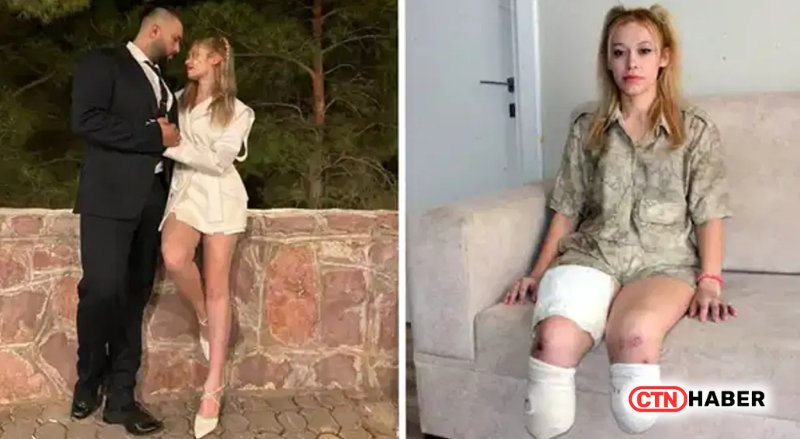 Kahramanmaraş'ta Şoförsüz TIR Kazası: İrem Karatutlu İki Bacağını Kaybetti - görsel 1
