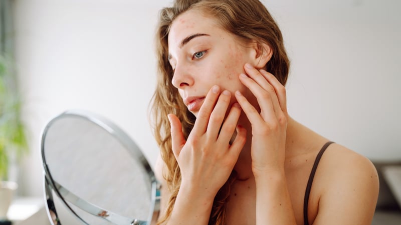 Kışın Cilt Bakımı Nasıl Yapılır? Soğuk Havalar İçin 7 Etkili Öneri - görsel 1