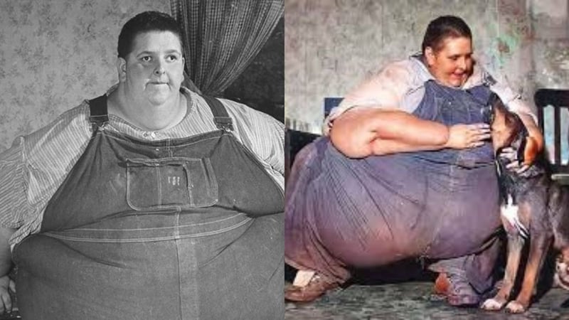 En Şişman İnsan Nasıl 400 Kilo Verdi? Gerçek Hikâye - görsel 1