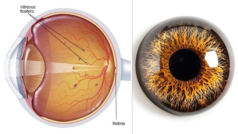 Yüzen Noktalar Nedir? Gözde Uçuşan Cisimlerin Bilimsel Açıklaması - görsel 1