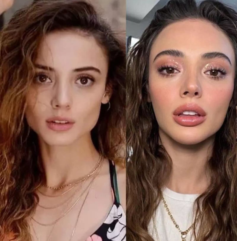 Teşkilat’ın Yeni Yıldızı Rabia Soytürk’ün Eski Hali Gündem Oldu! Estetik İddialarına Net Yanıt - görsel 2