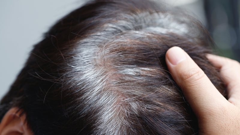 Genç Yaşta Saç Beyazlaması Kanser Riskine Karşı Vücudun Savunması Olabilir - görsel 1