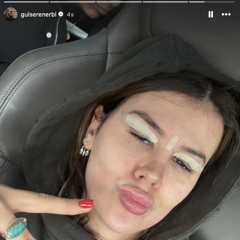 Mehmet Ali Erbil’in Eşi Gülseren Ceylan Göz Kapağı Ameliyatı Oldu - görsel 1