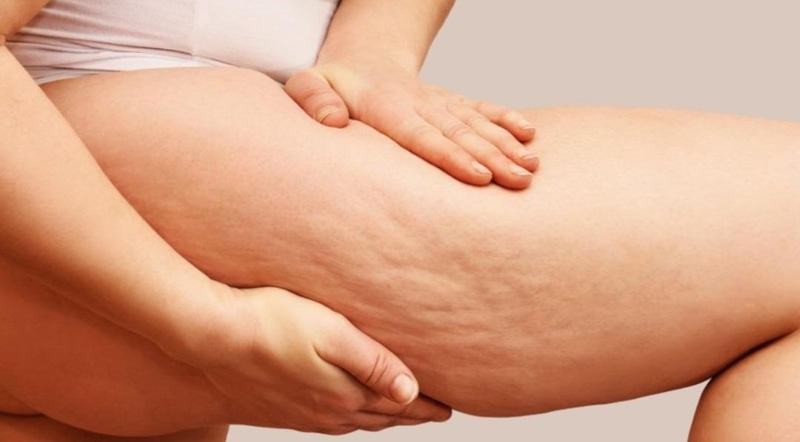 Evde Selülit İksiri Nasıl Yapılır? Pancar ve Havuçlu Doğal Tarif - görsel 1