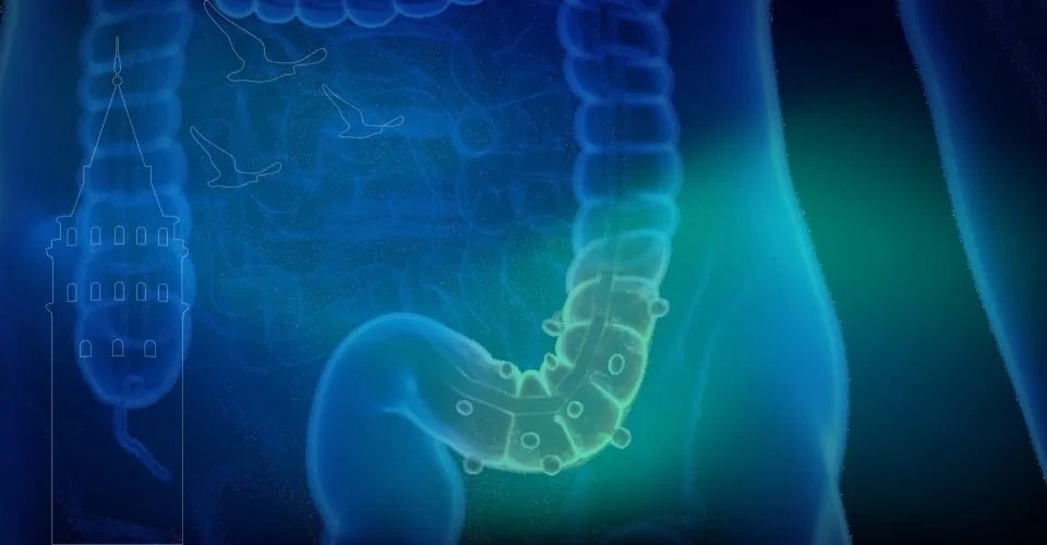 Murat Cemcir’i Yoğun Bakıma Götüren Sinsi Tehlike: Divertikül Kanaması Uyarısı - görsel 3